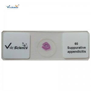 100шт комплект человеческих патологий слайды микроскопические подготовленные слайды