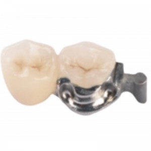 Точная привязанность