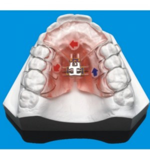 Ортодонтическая серия
